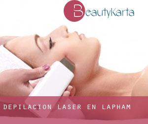 Depilación laser en Lapham