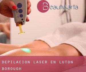 Depilación laser en Luton (Borough)