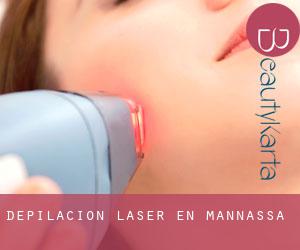 Depilación laser en Mannassa