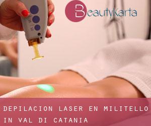Depilación laser en Militello in Val di Catania
