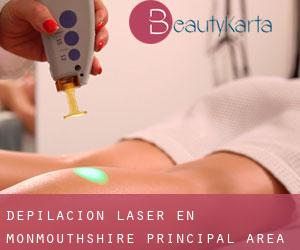 Depilación laser en Monmouthshire principal area