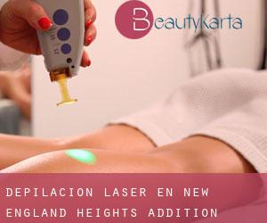 Depilación laser en New England Heights Addition