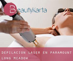 Depilación laser en Paramount-Long Meadow