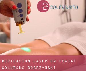 Depilación laser en Powiat golubsko-dobrzyński