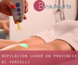 Depilación laser en Provincia di Vercelli