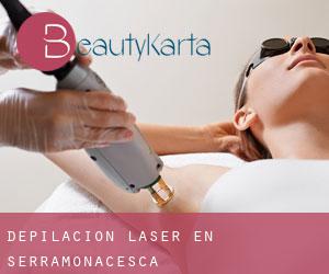 Depilación laser en Serramonacesca