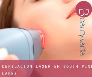 Depilación laser en South Pine Lakes Depilación laser en South Pine Lakes