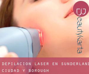 Depilación laser en Sunderland (Ciudad y Borough)