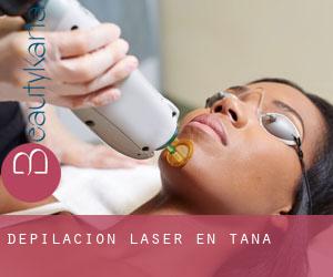 Depilación laser en Tana