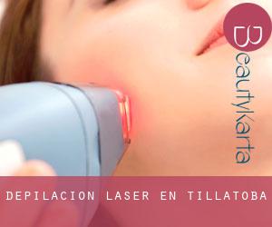 Depilación laser en Tillatoba