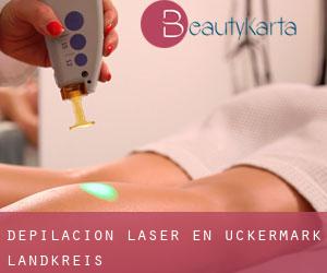 Depilación laser en Uckermark Landkreis