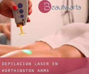 Depilación laser en Worthington Arms