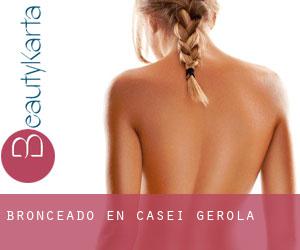 Bronceado en Casei Gerola