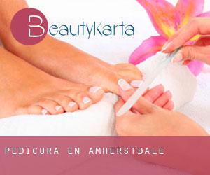 Pedicura en Amherstdale