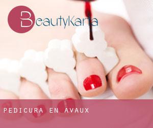 Pedicura en Avaux