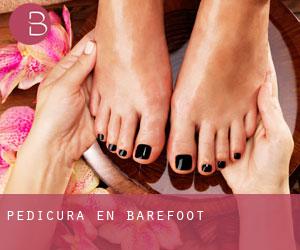 Pedicura en Barefoot