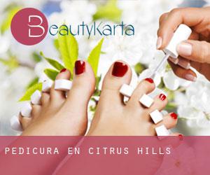 Pedicura en Citrus Hills