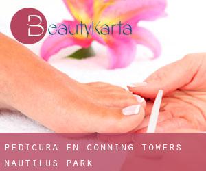 Pedicura en Conning Towers-Nautilus Park
