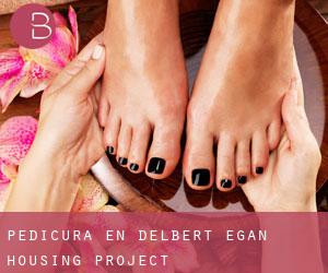 Pedicura en Delbert Egan Housing Project