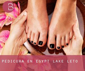 Pedicura en Egypt Lake-Leto