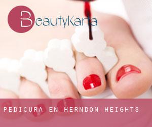 Pedicura en Herndon Heights